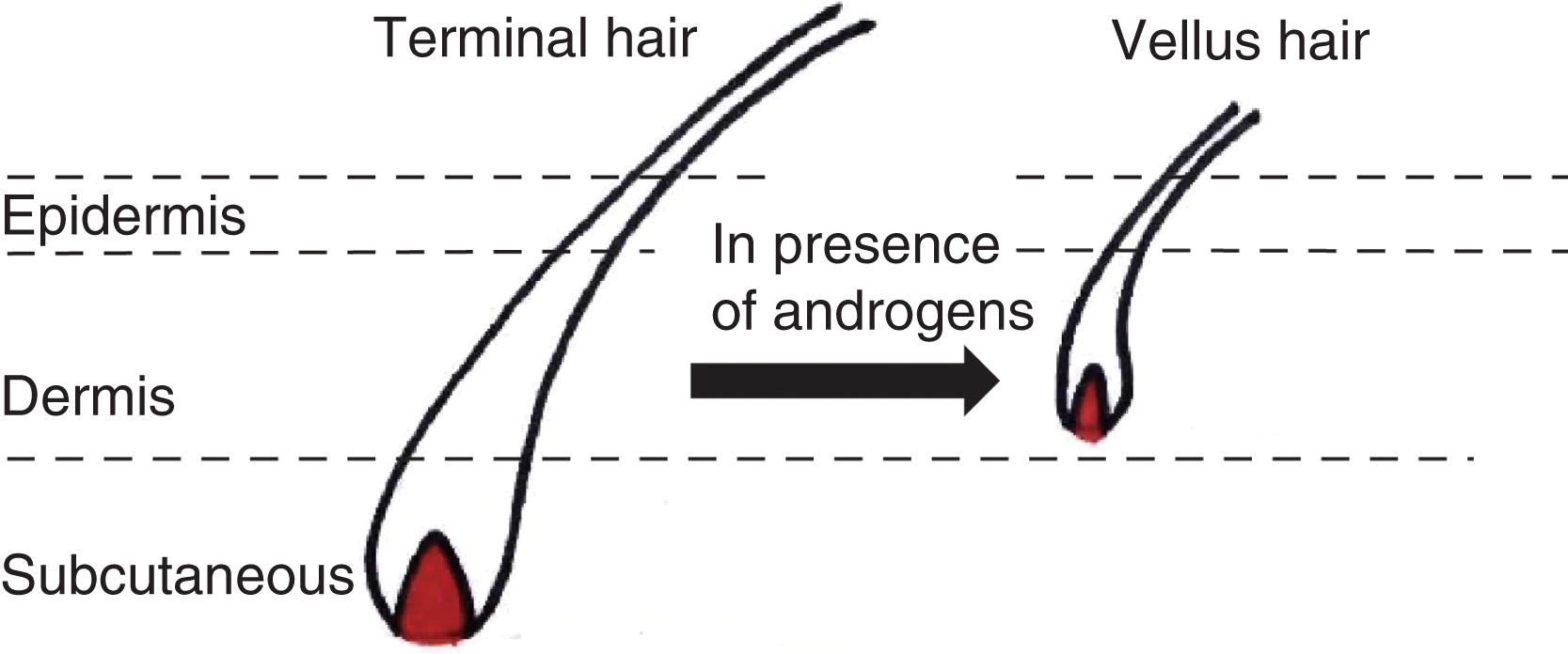 dermatology Does masturbation cause hair loss for men? Medical