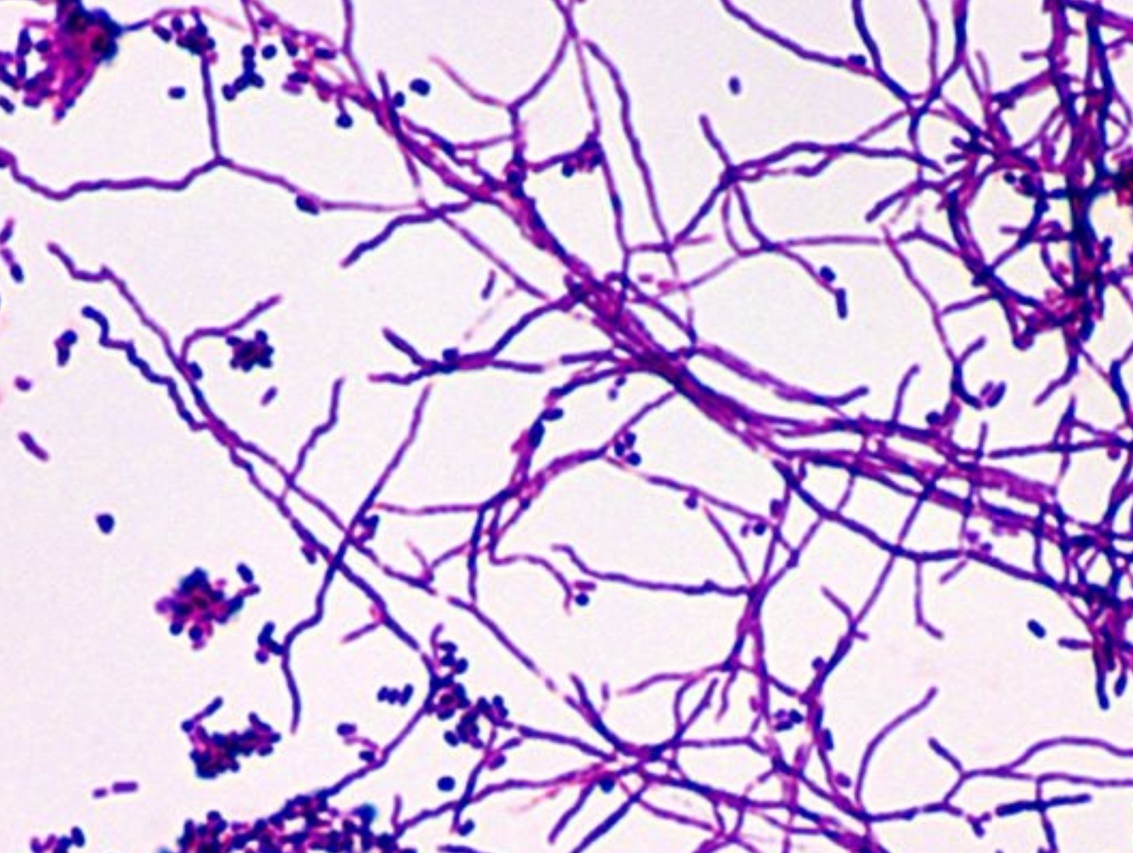 microbiology Are acidfast bacteria Grampositive or
