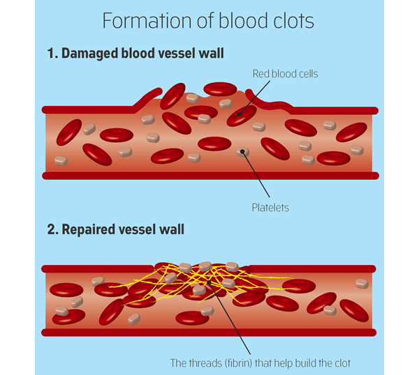 blood Does erythrocyte aggregation serve a useful function? Medical