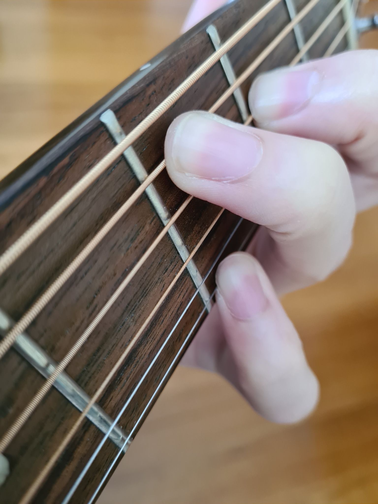 guitar Advice for positioning my pinky on the fretboard, it is