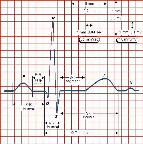 c how to get values From a scanned ECG image? Stack Overflow