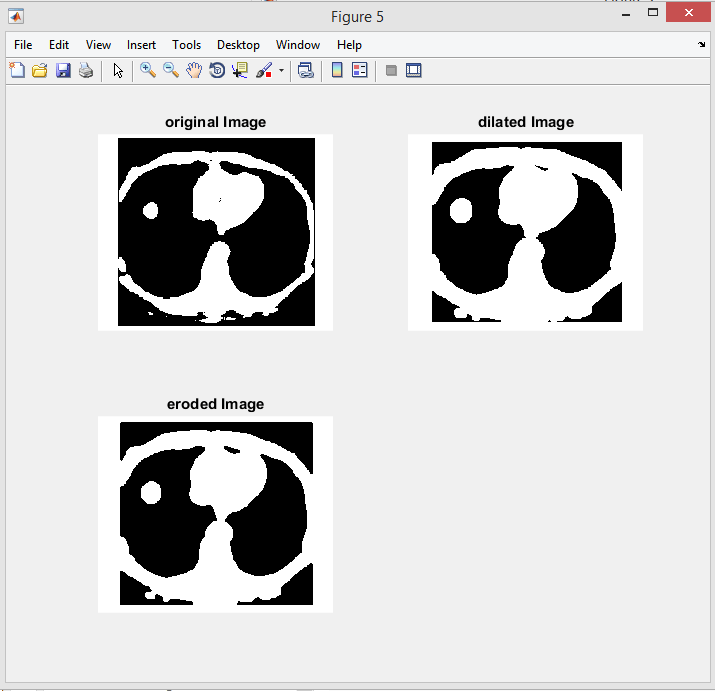 MATLAB CODES Morphological Operations for Binary.