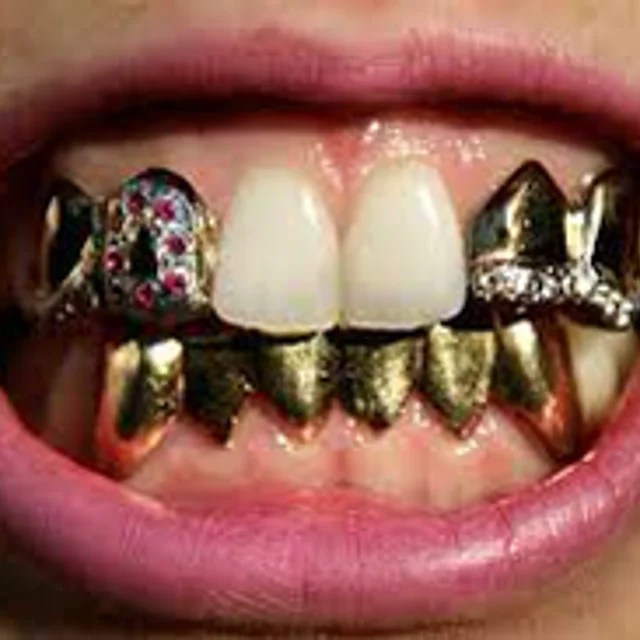 Gold Teeth Caps