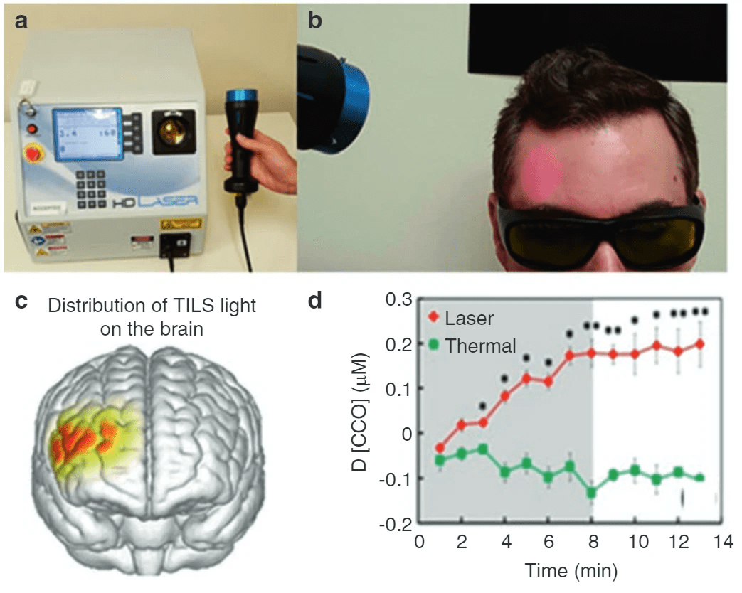 Science Advances：宋艳课题组发现经颅近红外激光刺激可提升人类工作记忆 哔哩哔哩