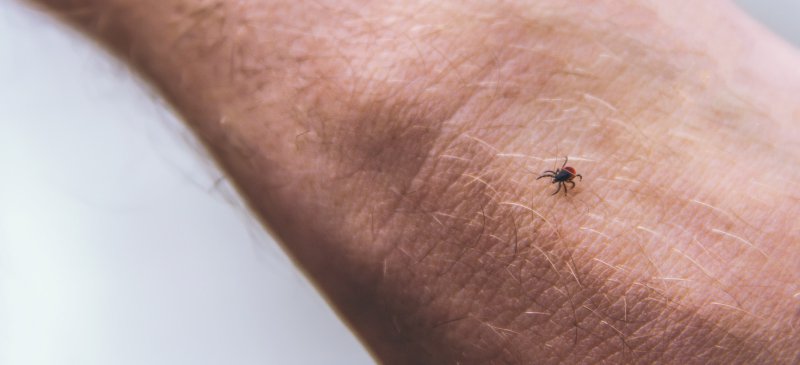 Itching can last for up to two weeks, says raupp. Chigger Bites (+ 5 Natural Home Remedies for Chigger Bite ...