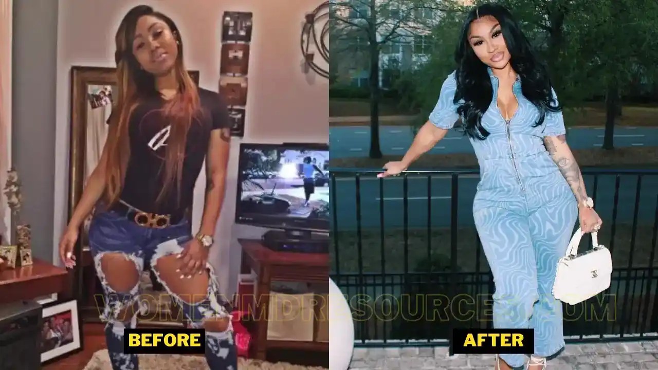 Ari Fletcher Plastic Surgery. Pregnancy Details, BeforeAfter, And