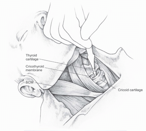 Scenario 23 Head and Neck: 411 Practice Questions:.