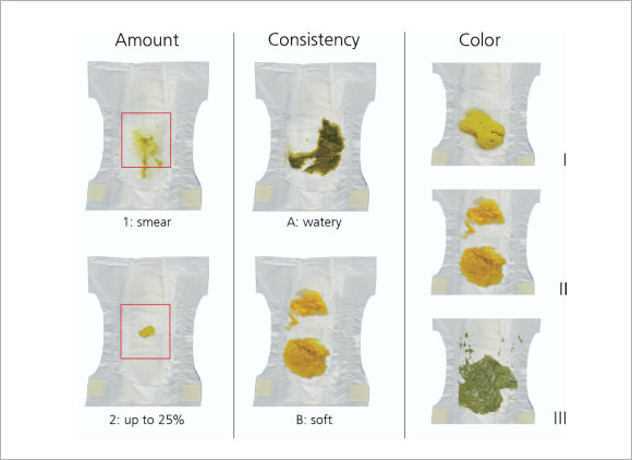  8 sample stool color charts sample templates