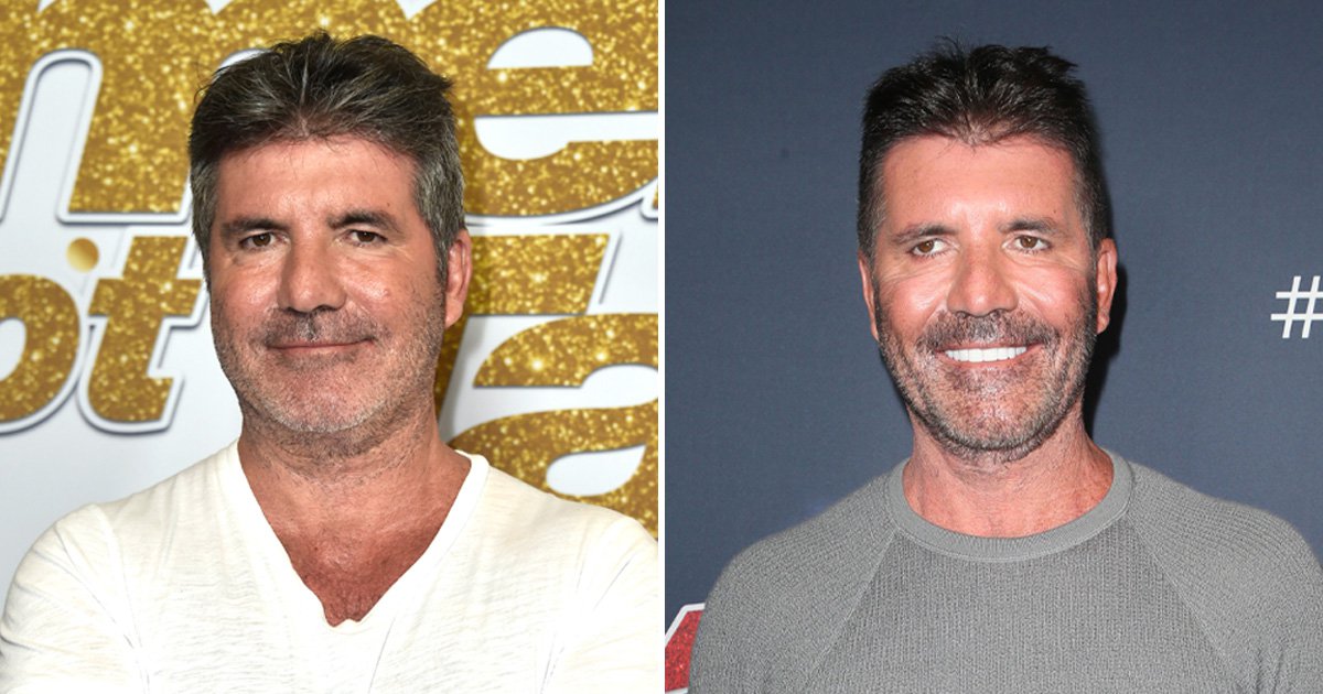 Simon Cowell face explained from surgery rumours to vegan diet