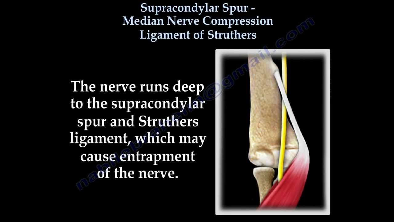 Median nerve compression ,Supracondylar process