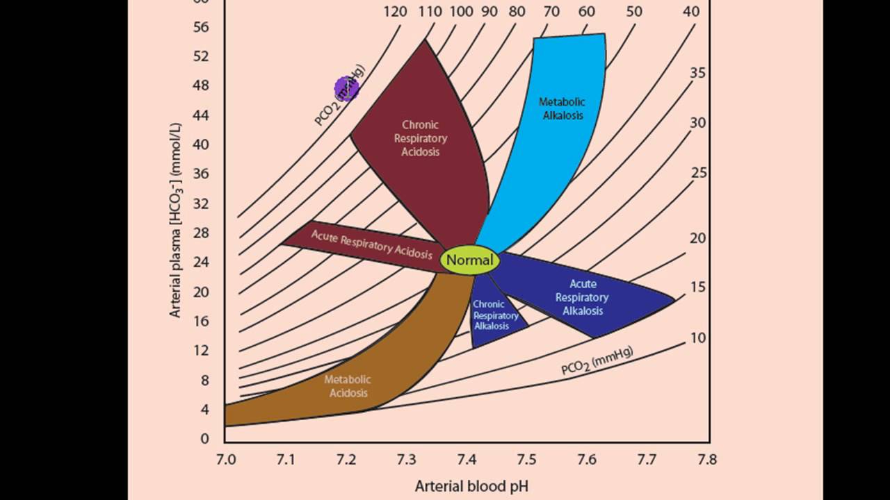 Part 2 Acidosis and Alkalosis Metabolic or Respiratory.mp4 YouTube