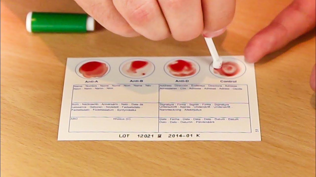 Eigene Blutgruppe per Schnelltest bestimmen YouTube