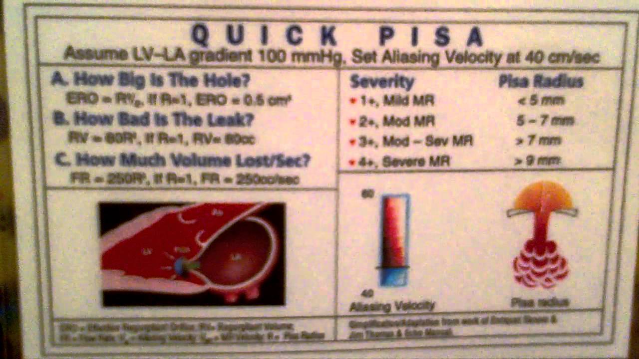 quick pisa for mitral regurgitation YouTube