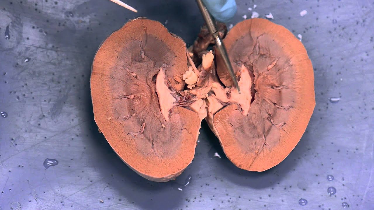 Sheep Kidney Dissection A&P II YouTube
