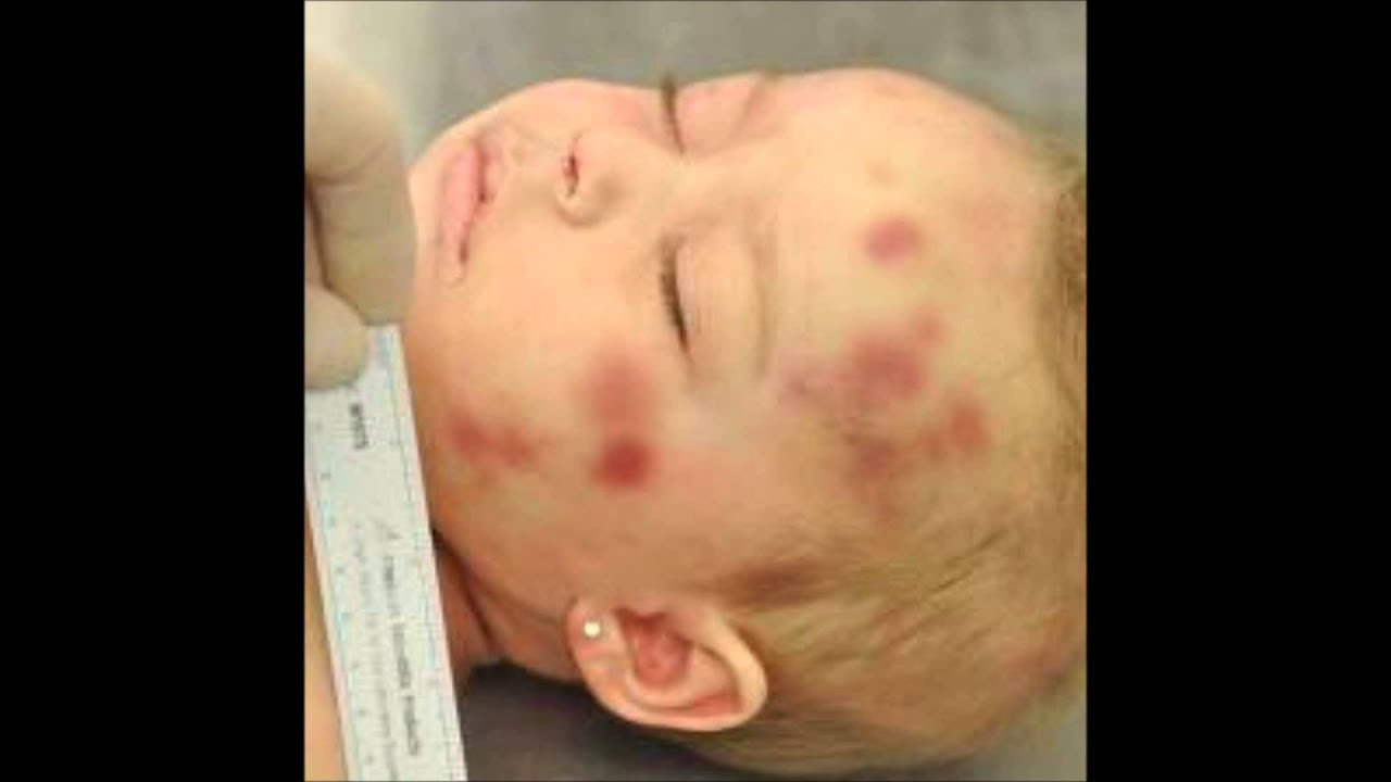 shaken baby syndrome YouTube