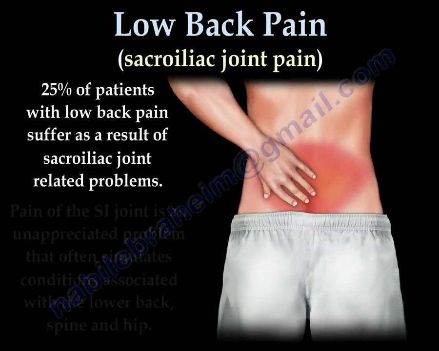 Sacroiliac Joint pain, animation Everything You Need To Know Dr
