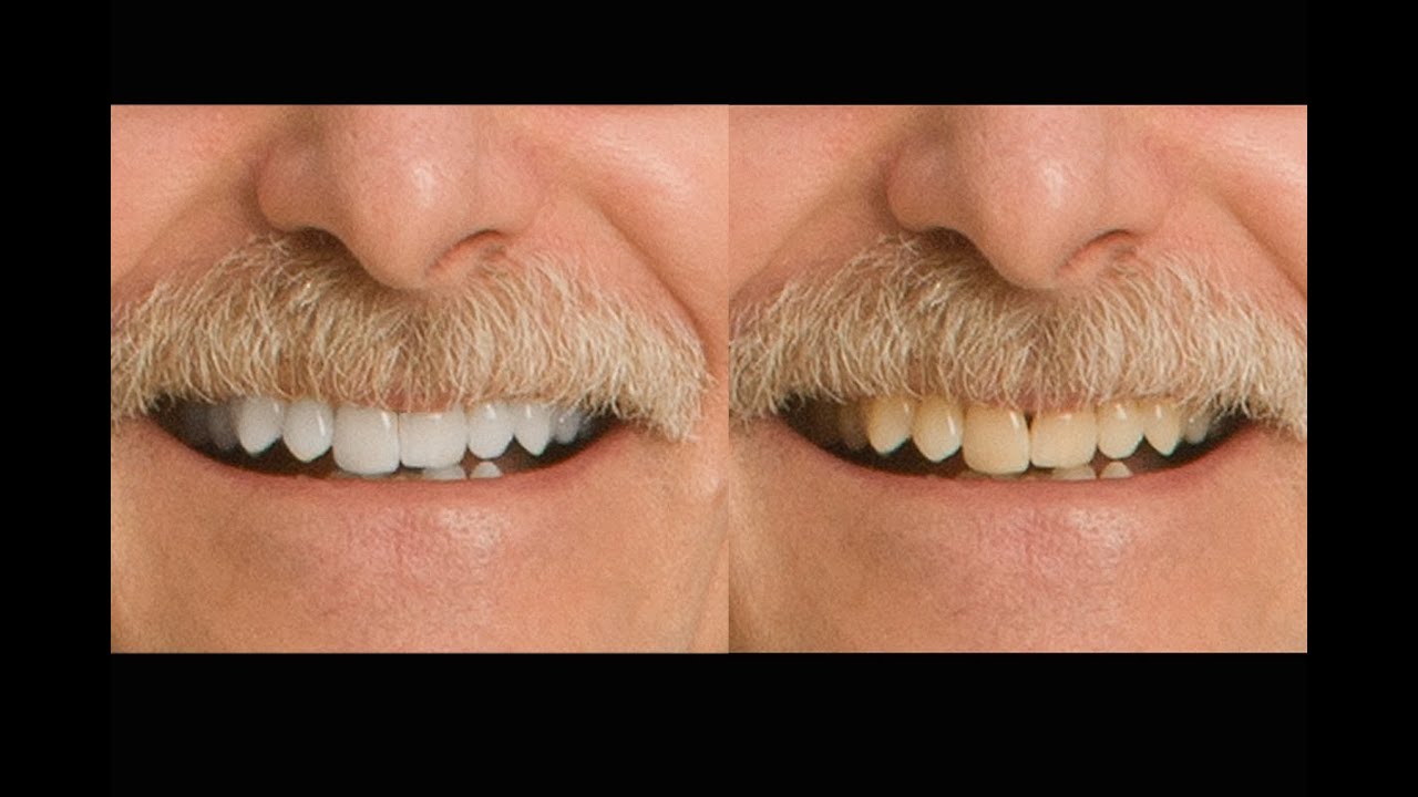 Whiten Teeth in CS6, fix gaps in teeth YouTube