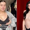 ‘I got a boob job from Kylie Jenner’s surgeon – it was eye-opening’