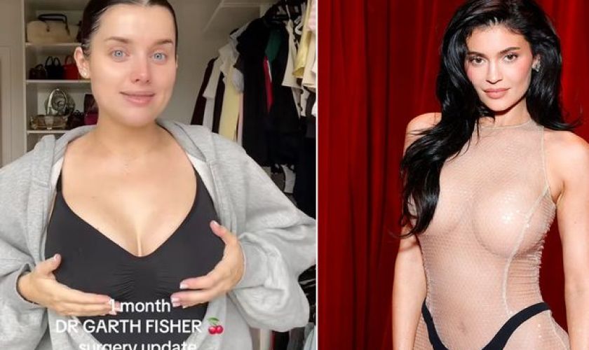 ‘I got a boob job from Kylie Jenner’s surgeon – it was eye-opening’ ‘I got a boob job from Kylie Jenner’s surgeon – it was eye-opening’