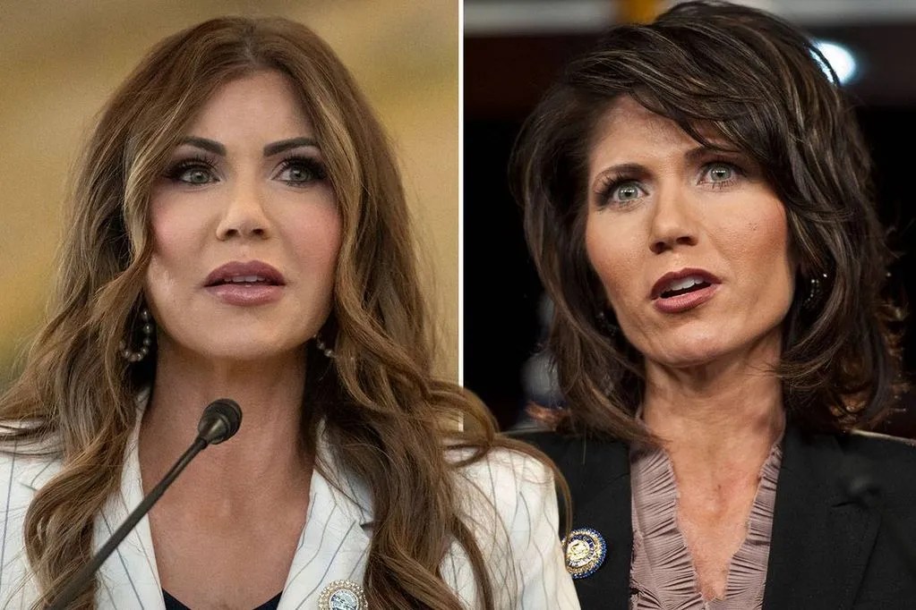 Kristi Noem's appearance before plastic surgery revealed in throwback