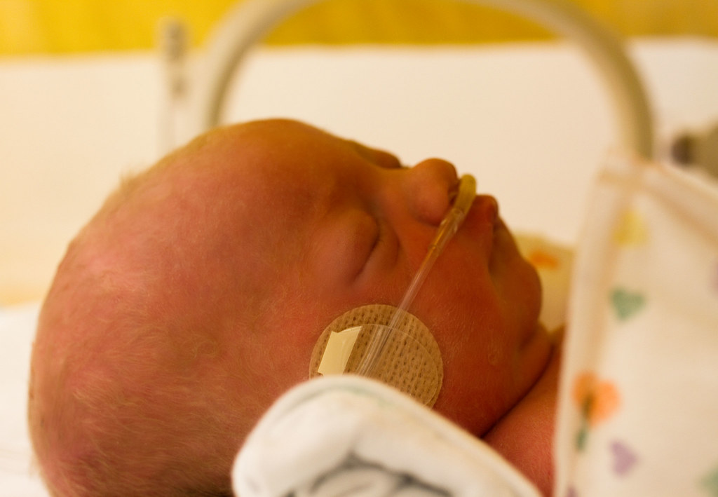 PREMATURE BABIES AT 33 WEEKS. AT 33 WEEKS Premature babies at 33 weeks. Baby einstein party