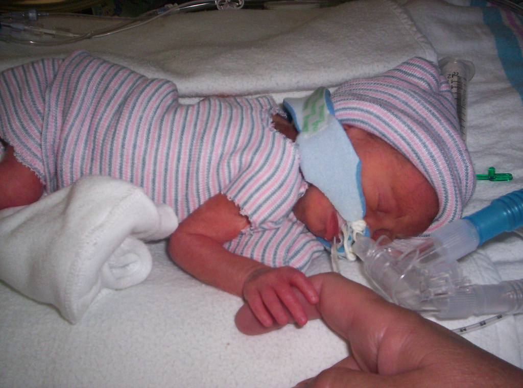 PREMATURE BABY BORN AT 30 WEEKS AT 30 WEEKS A BABIES TEMPERATURE Blog.hr