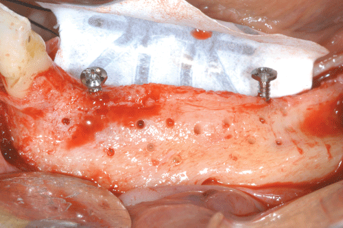 ClinMed International Library Surgery Guidelines for