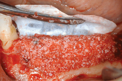 ClinMed International Library Surgery Guidelines for