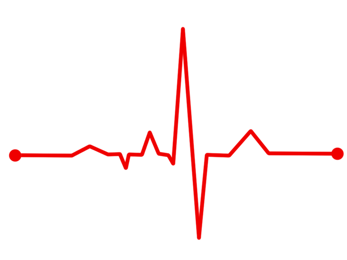 Ekg Drawing Free download on ClipArtMag