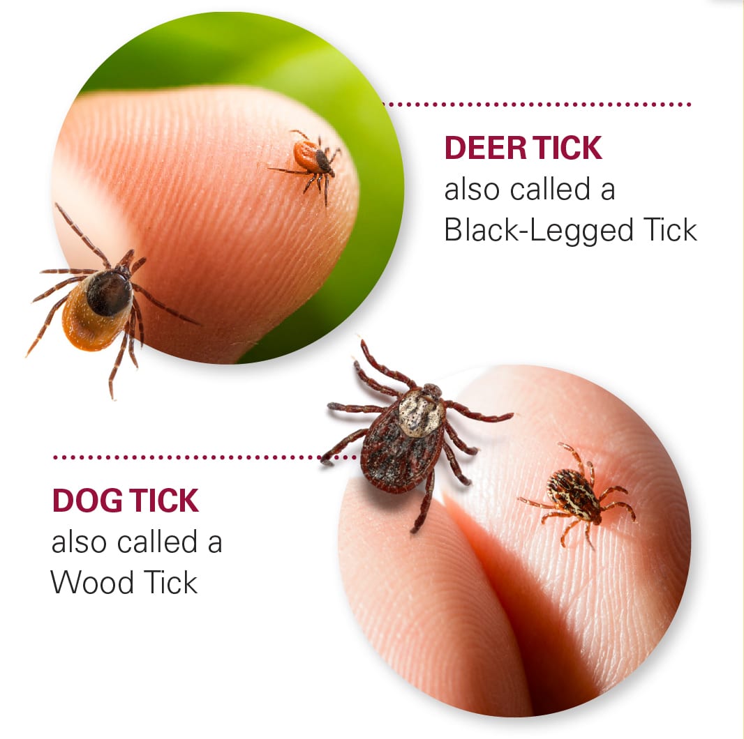 DFD's Guide to Ticks DFD Russell Medical Centers DFD Russell Medical Centers