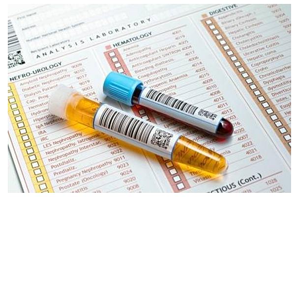Thyroid Profile II Dr Scott's Lab Tests