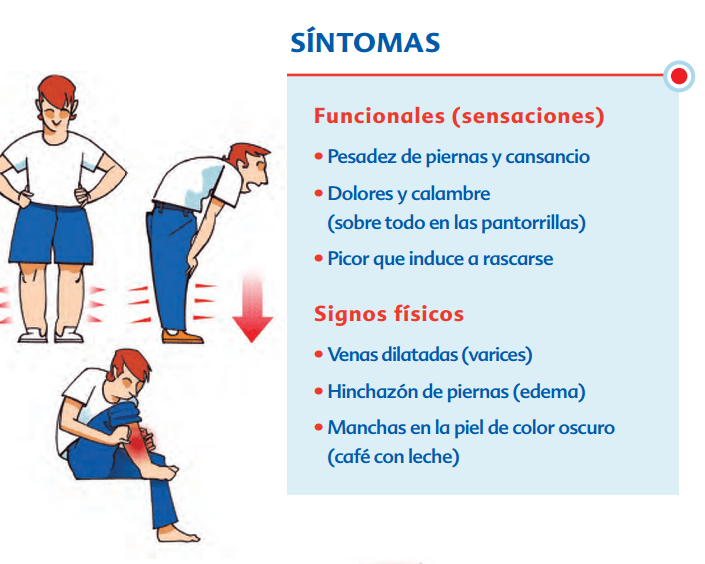 CONSEJOS PARA PROBLEMAS DE CIRCULACIÓN EN LAS PIERNAS