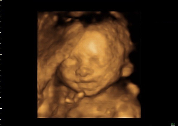 24 weeks Baby in 3D Ultrasound Flickr Photo Sharing!