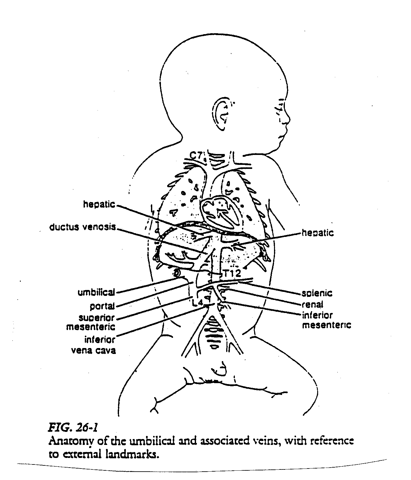 Ekg Drawing at GetDrawings Free download