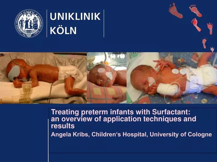 PPT Treating preterm infants with Surfactant an overview of application techniques and
