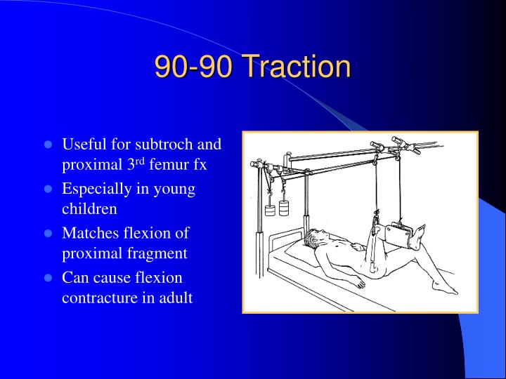 PPT Orthopaedic Traction PowerPoint Presentation ID210938
