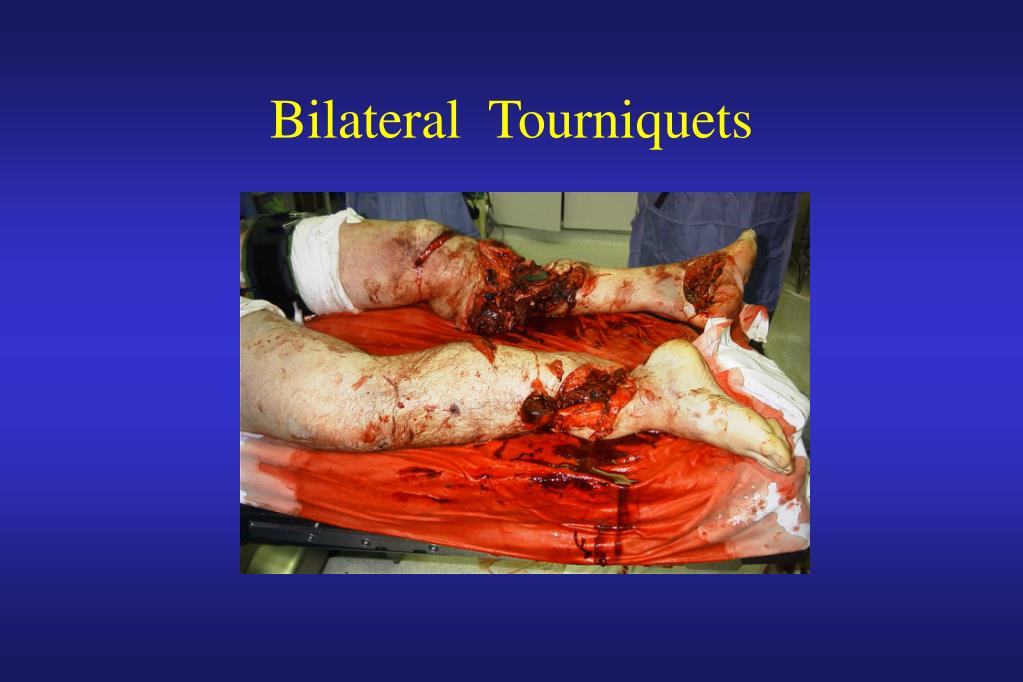 PPT Hypotension, Shock, Hemorrhage and IV Fluid