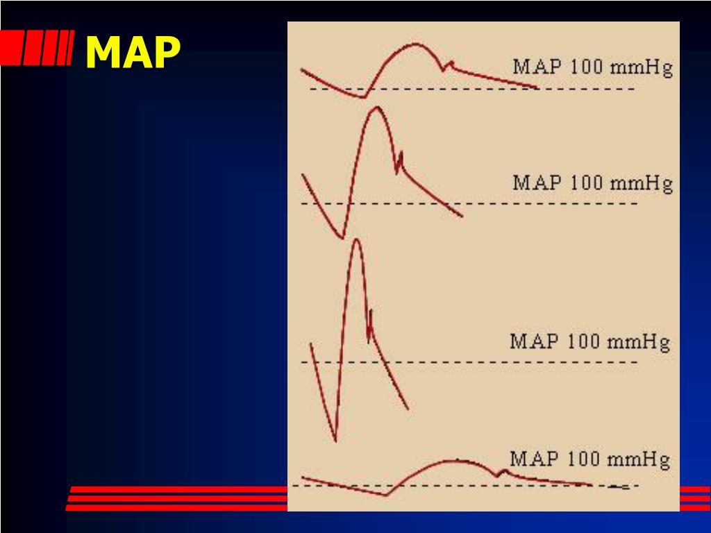 PPT Critical Care Monitoring Nuts and Bolts PowerPoint