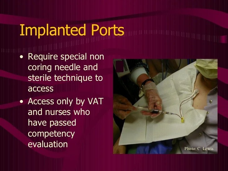 Central Venous Access Devices Made Incredibly Easy!