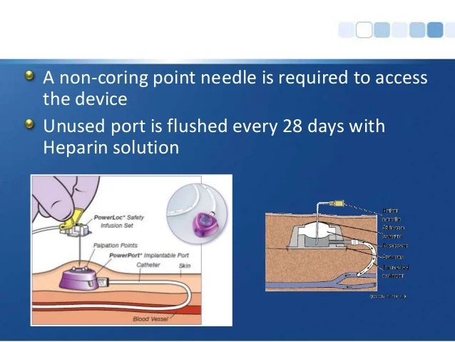 Central Venous Access