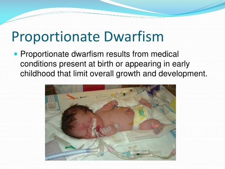 PPT Dwarfism PowerPoint Presentation ID2211221