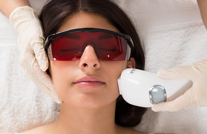 Advanced Q Switch Laser Treatment In Hyderabad Ira Clinic
