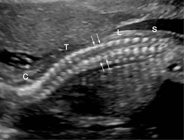 Fetal Imaging Obgyn Key