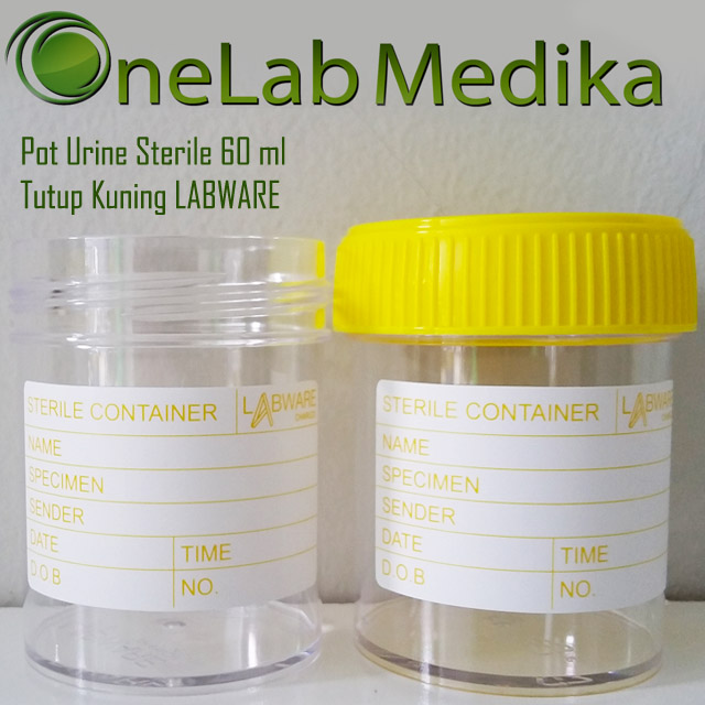 Pot Urine Sterile 60 ml Tutup Kuning LABWARE
