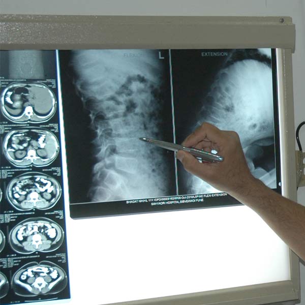 XRays and their harmful effects