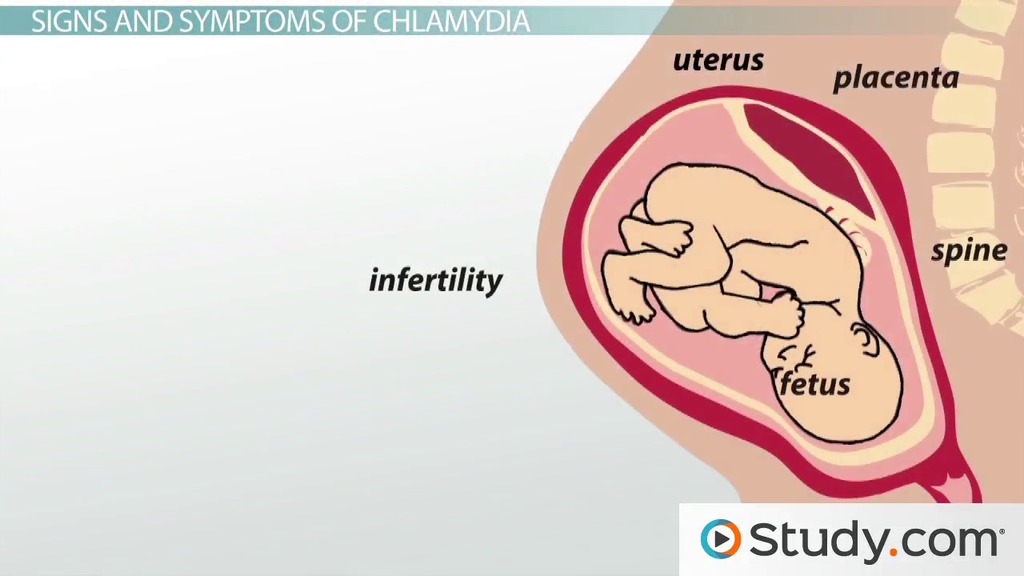 What Is Chlamydia Trachomatis? Symptoms, Signs