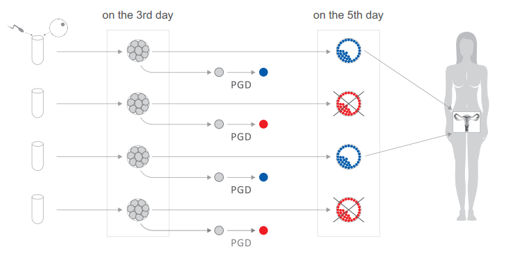 How Much Does PGD Cost in Kenya? Surrogate Mother Kenya