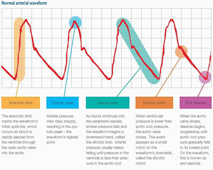 Hemodynamic monitoring Thoracic Key