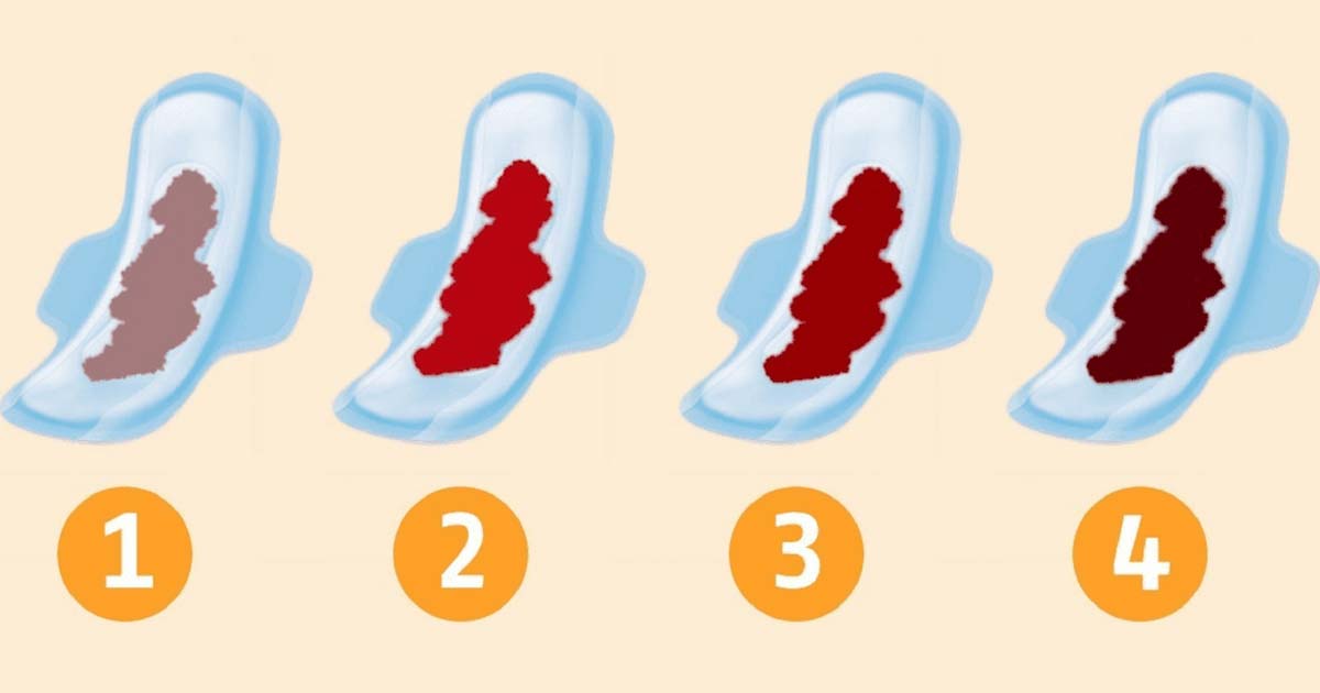 Al menstrual ¿De que color es la sangre? Atenta al fluido, indica que tan saludable realmente