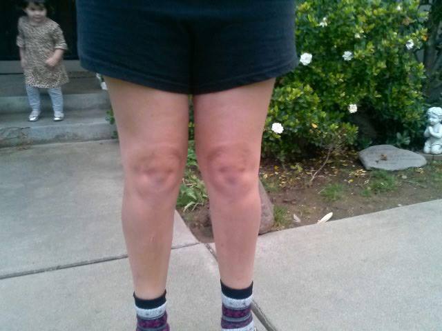 "Knee Faces" Caught in the Wild (GALLERY)